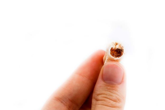 How To Prevent Tooth Decay (1) a person holds a tooth suffering from tooth decay