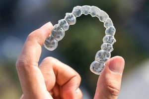 an example of someone holding invisalign clear aligners