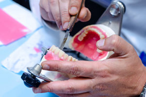 dentist displaying dentures model