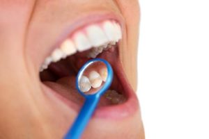 patient undergoing a dental exam