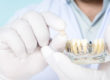 dentist showing a model of a dental implant