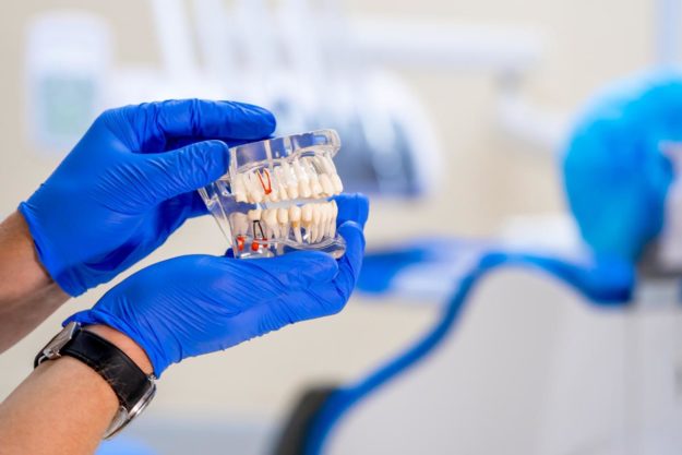 How Do Dental Implants Work a sample of teeth show a sample of dental implants